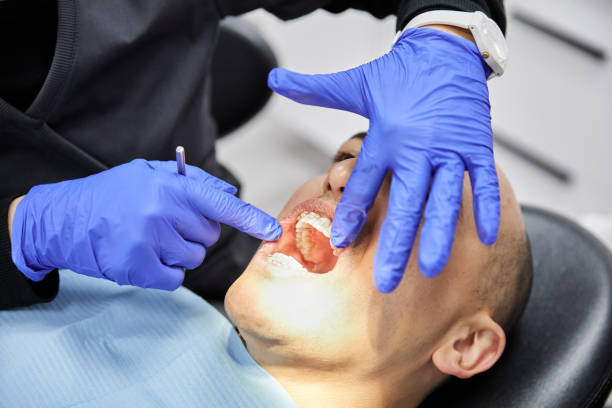 Best Emergency Gum Treatment in Parma Heights, OH