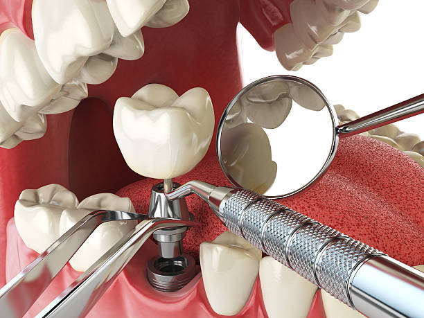 Best Emergency Denture Repair in Parma Heights, OH
